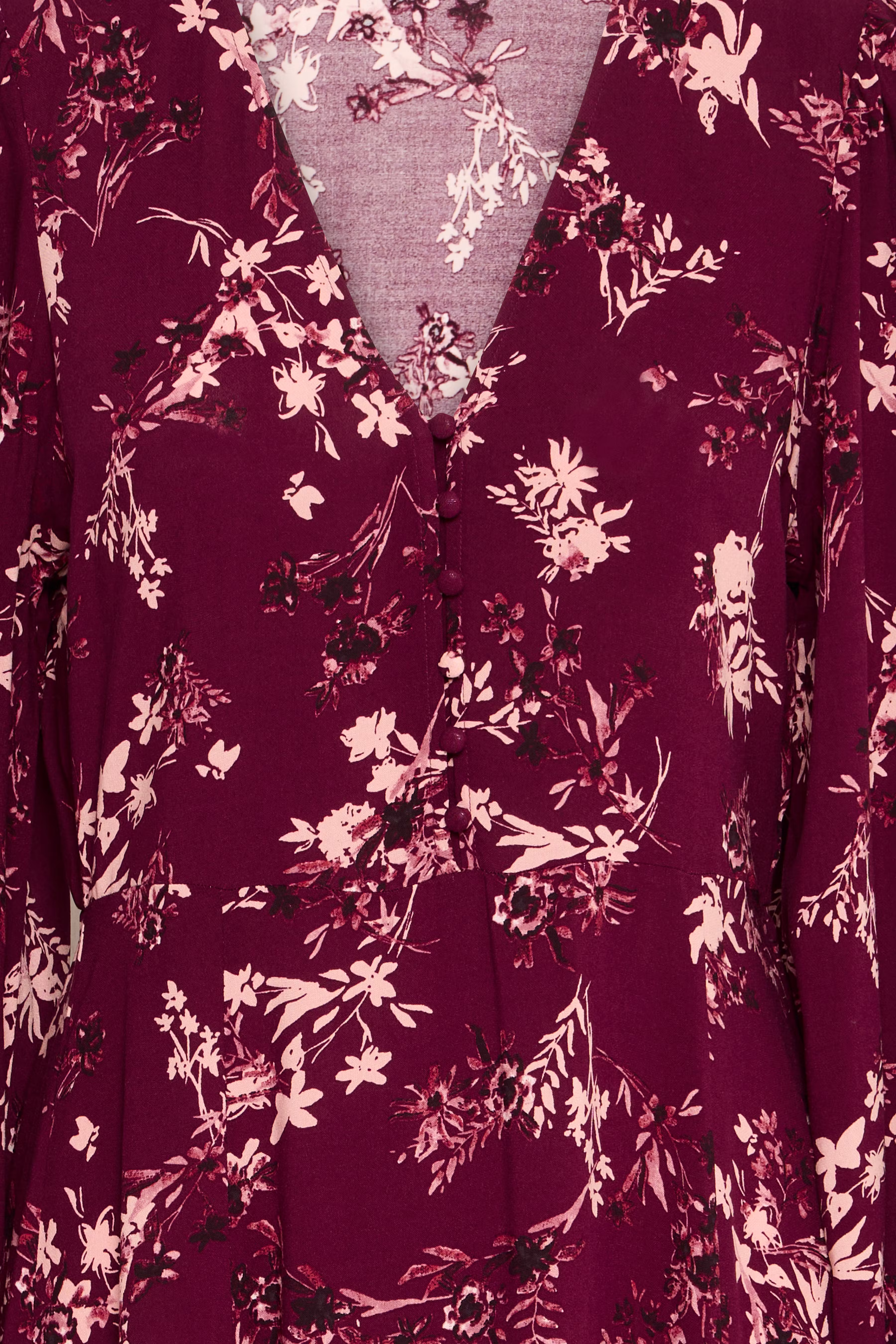 BYJOSA Kjole PACK DETAIL 20817069-205268